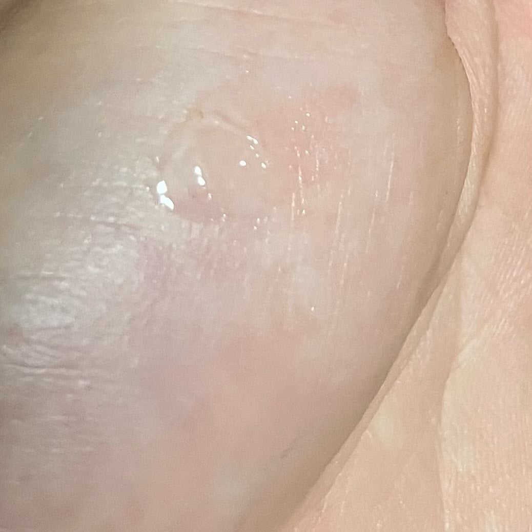 レチノール ボリューム リップセラム/primera/リップグロスを使ったクチコミ(3枚目)