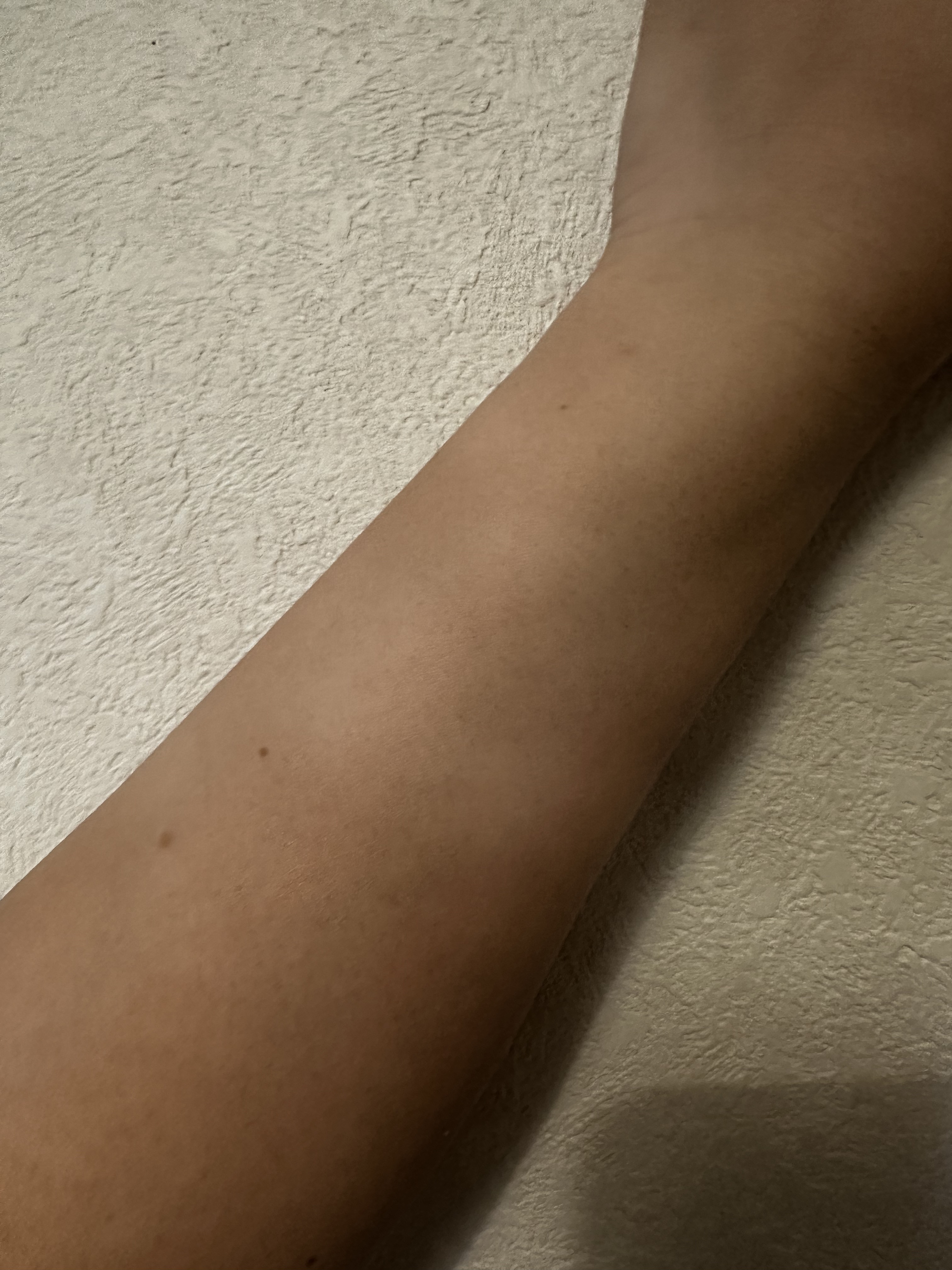 光脱毛器 VIO ホワイト/Sarlisi/家庭用脱毛器を使ったクチコミ（2枚目）