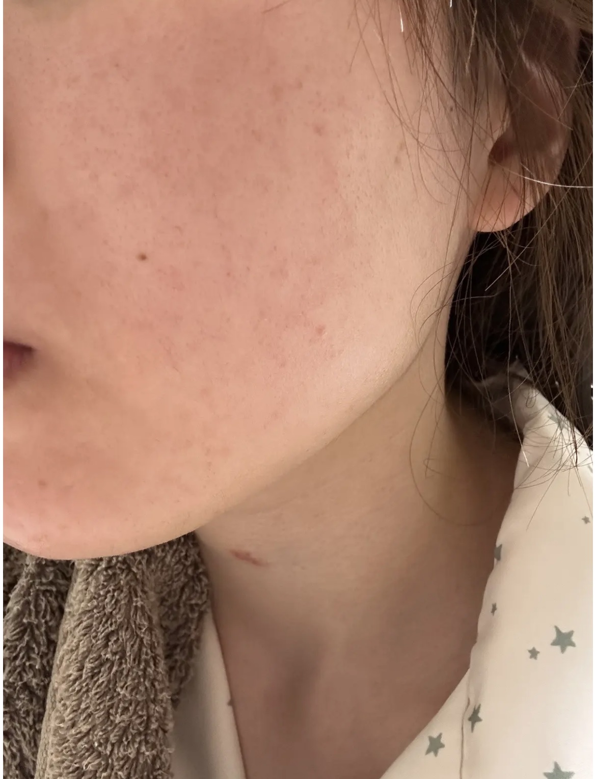 ベリーお元気？/ラッシュ/洗い流すパック・マスクを使ったクチコミ（3枚目）