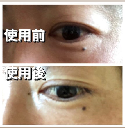 リクエス コンセントレート チャージ パッチ/クラブ/シートマスク・パックを使ったクチコミ(5枚目)