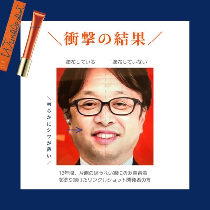 リンクルショット メディカル セラム N/リンクルショット/アイケア・アイクリームを使ったクチコミ(7枚目)