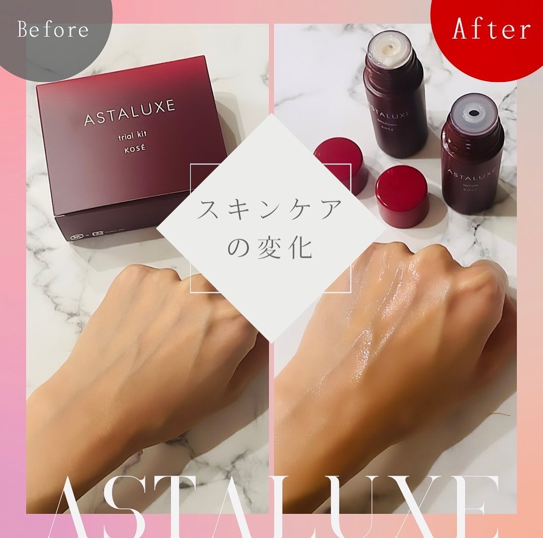 試してみた】コーセー アスタリュクス ローション AXの効果