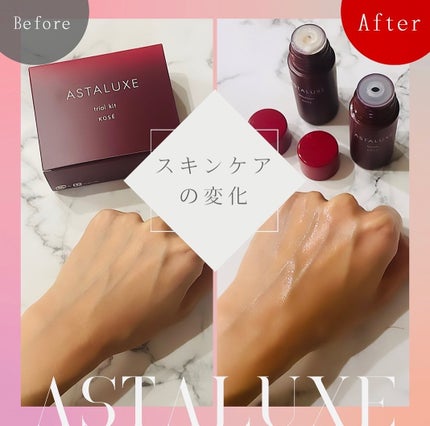 アスタリュクス ローション AX/コーセー/化粧水を使ったクチコミ(3枚目)