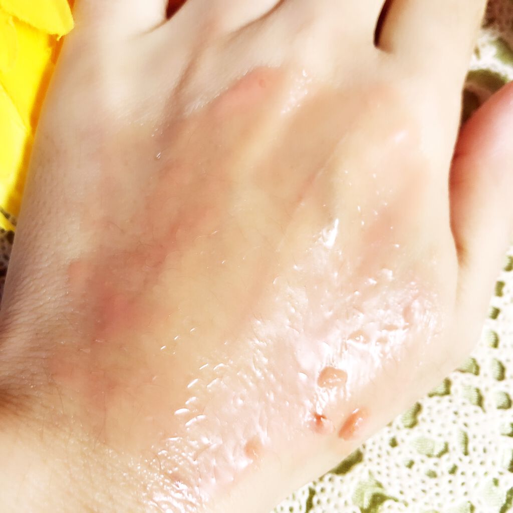 夢みるバーム 赤泥リンクルモイスチャー/ロゼット/クレンジングバームを使ったクチコミ(4枚目)