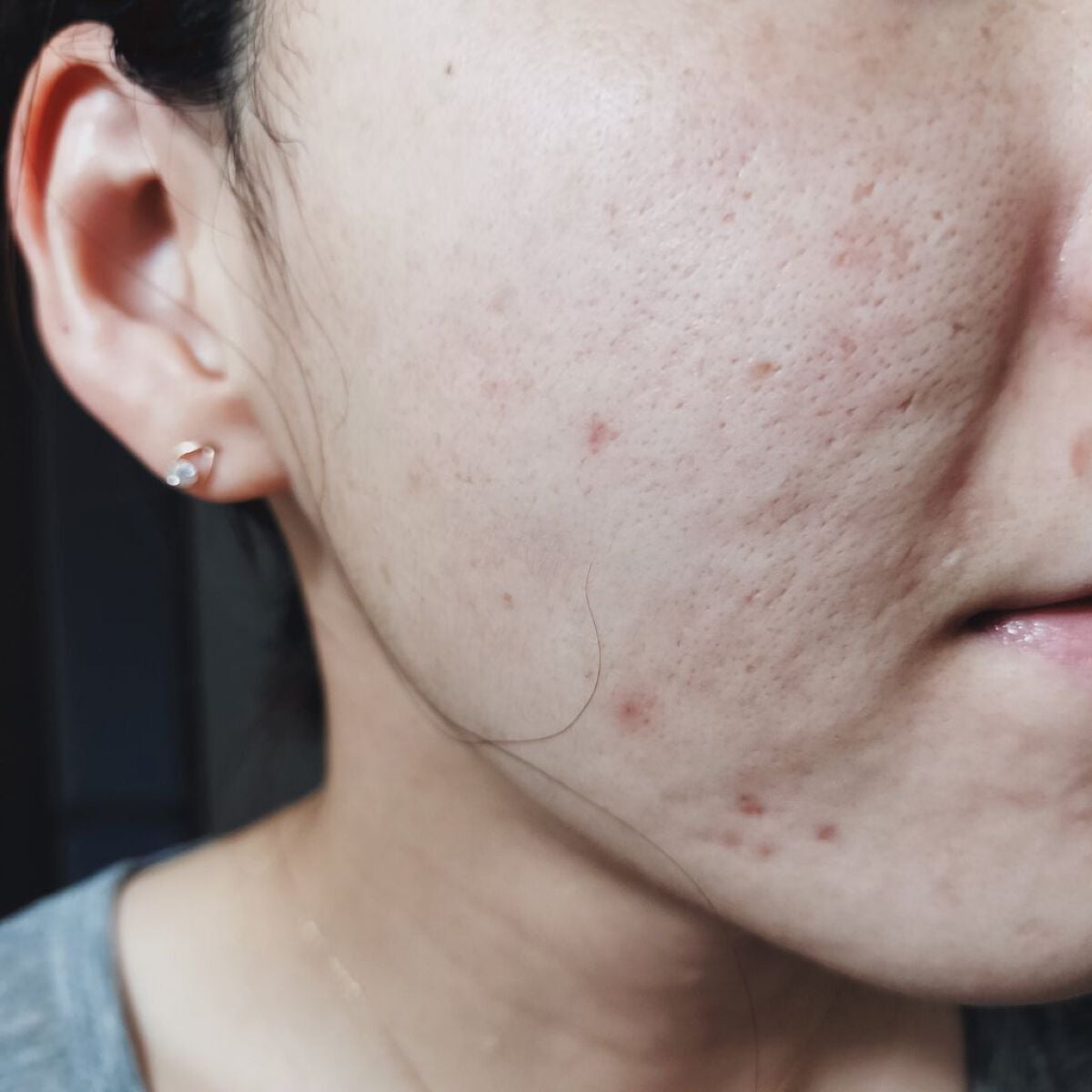 ビオオイル アルガンオイル/Melvita/フェイスオイルを使ったクチコミ(1枚目)