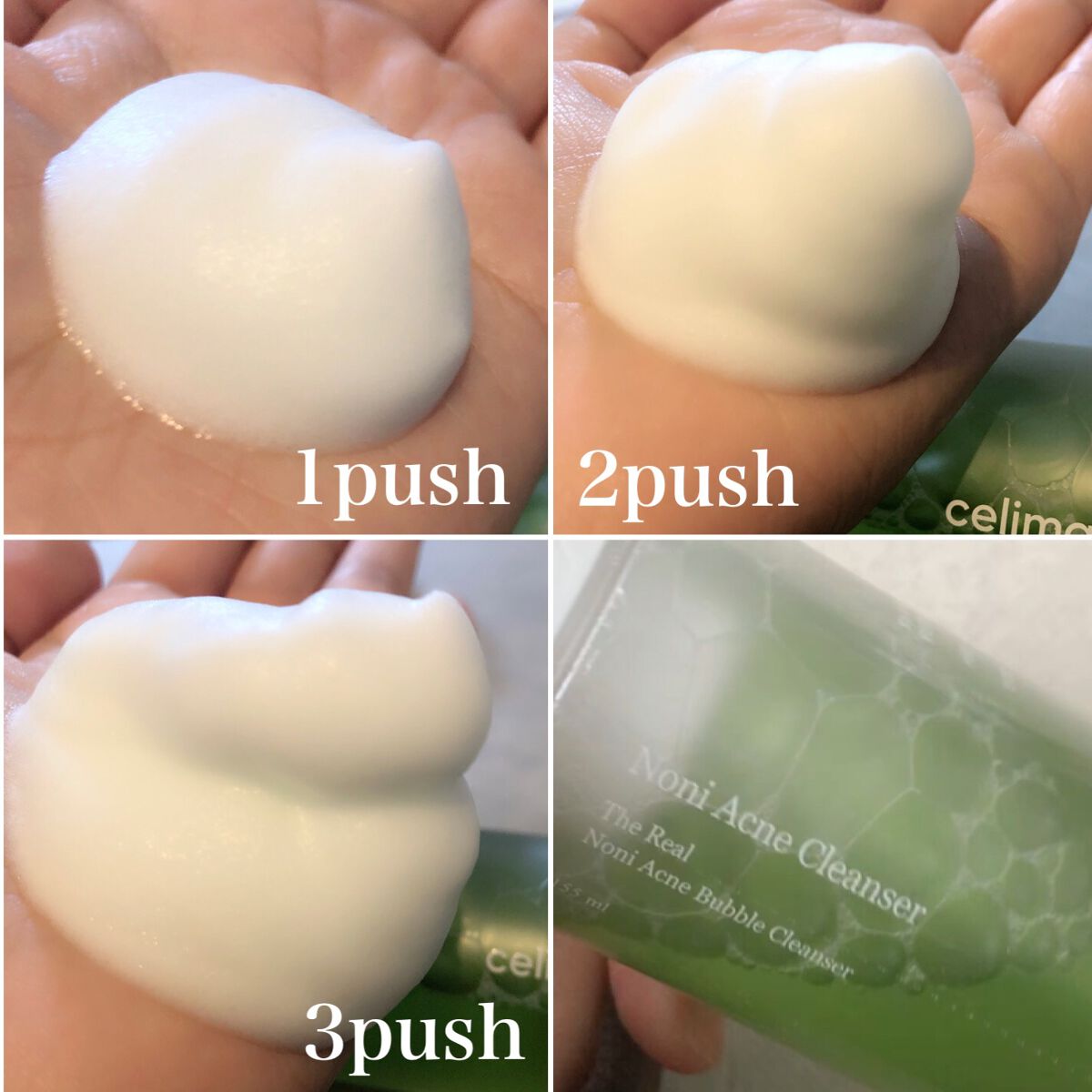 ザリアルノニアクネバブルクレンザー/celimax/泡洗顔を使ったクチコミ(2枚目)