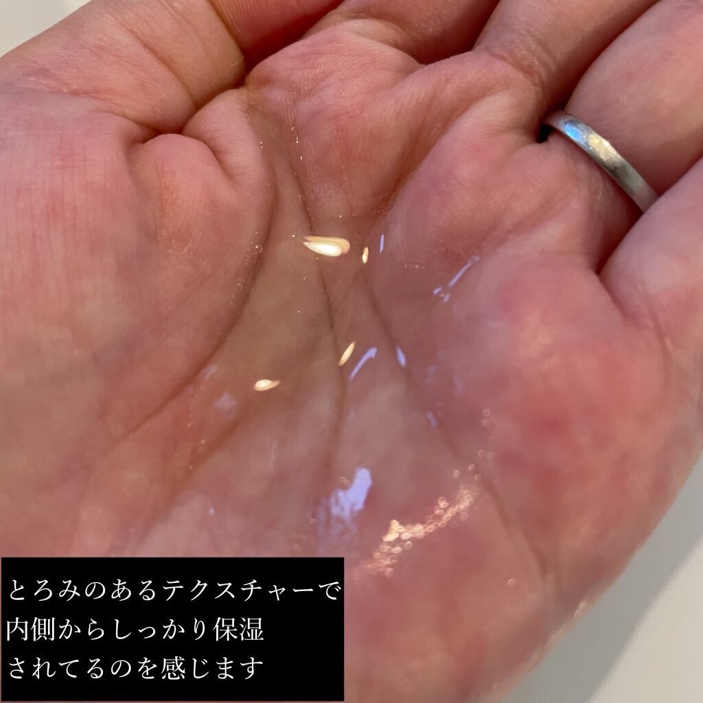 モイストケア ローション MB/d プログラム/化粧水を使ったクチコミ(3枚目)