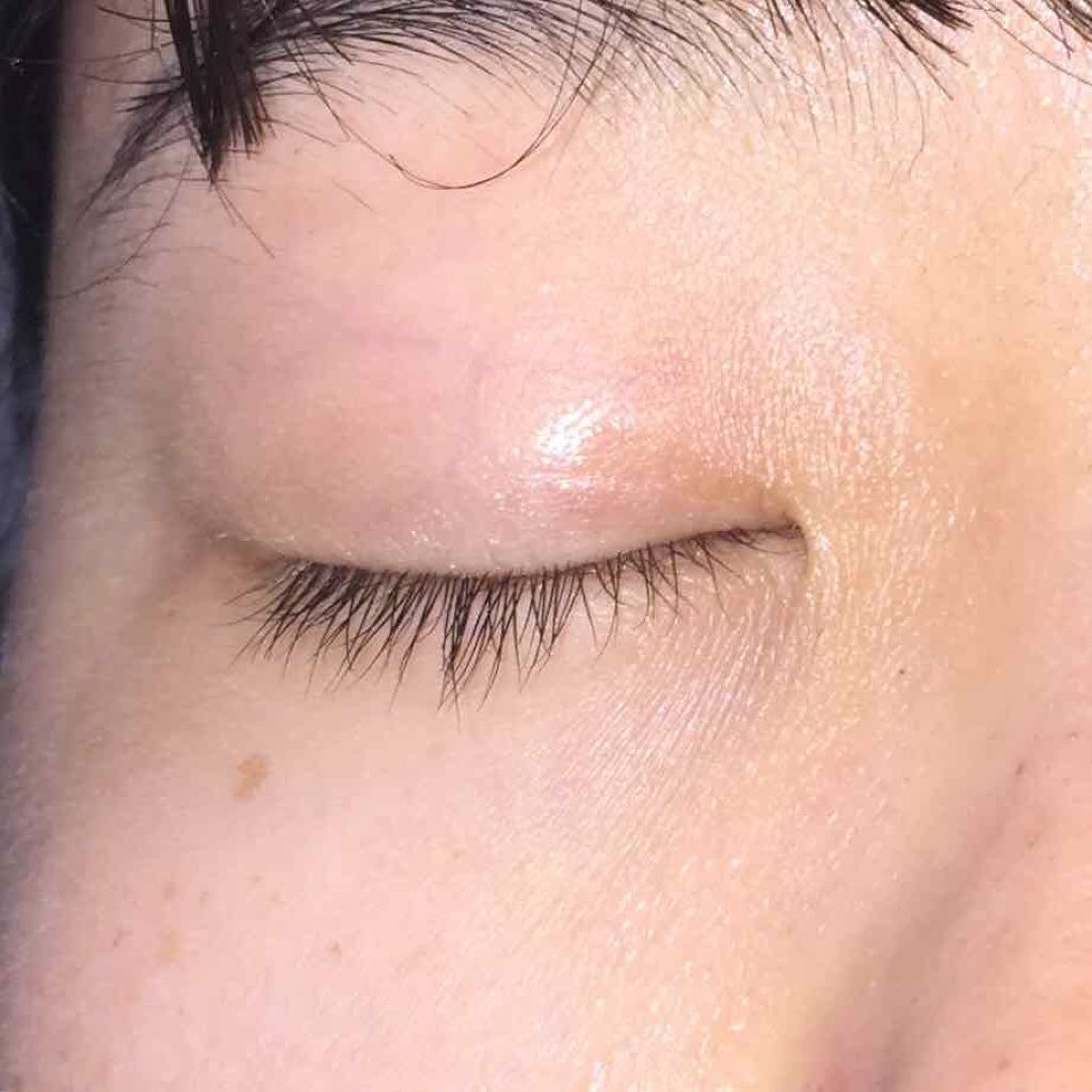 ローヤルゼリー配合 栄養ローション/DAISO/美容液を使ったクチコミ(4枚目)