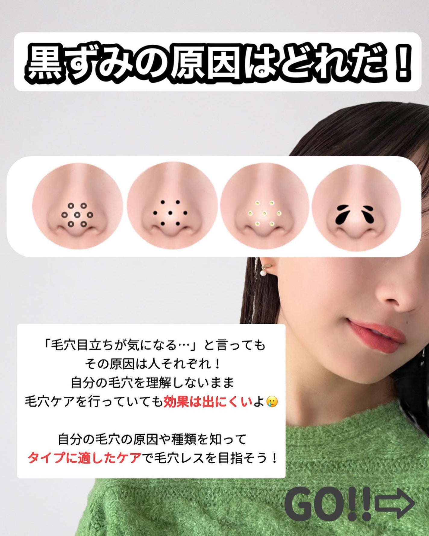 VC100エッセンスローション EX/ドクターシーラボⓇ/化粧水を使ったクチコミ(2枚目)