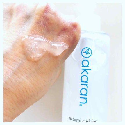 ナチュラルクッションピーリング/アカラン/ピーリングを使ったクチコミ(2枚目)