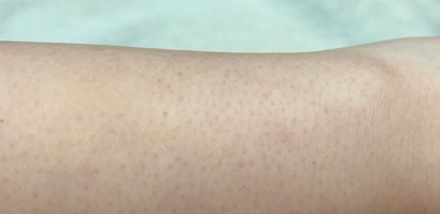 okaimononao on LIPS 「#PR#提供品TFITティーフィットCoverupproCon..」(3枚目)