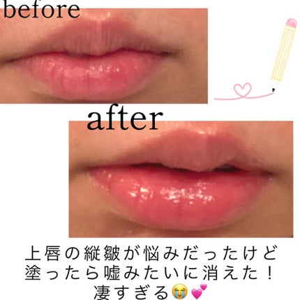 エッセンス リッププランパー/Visée/リッププランパーを使ったクチコミ(2枚目)