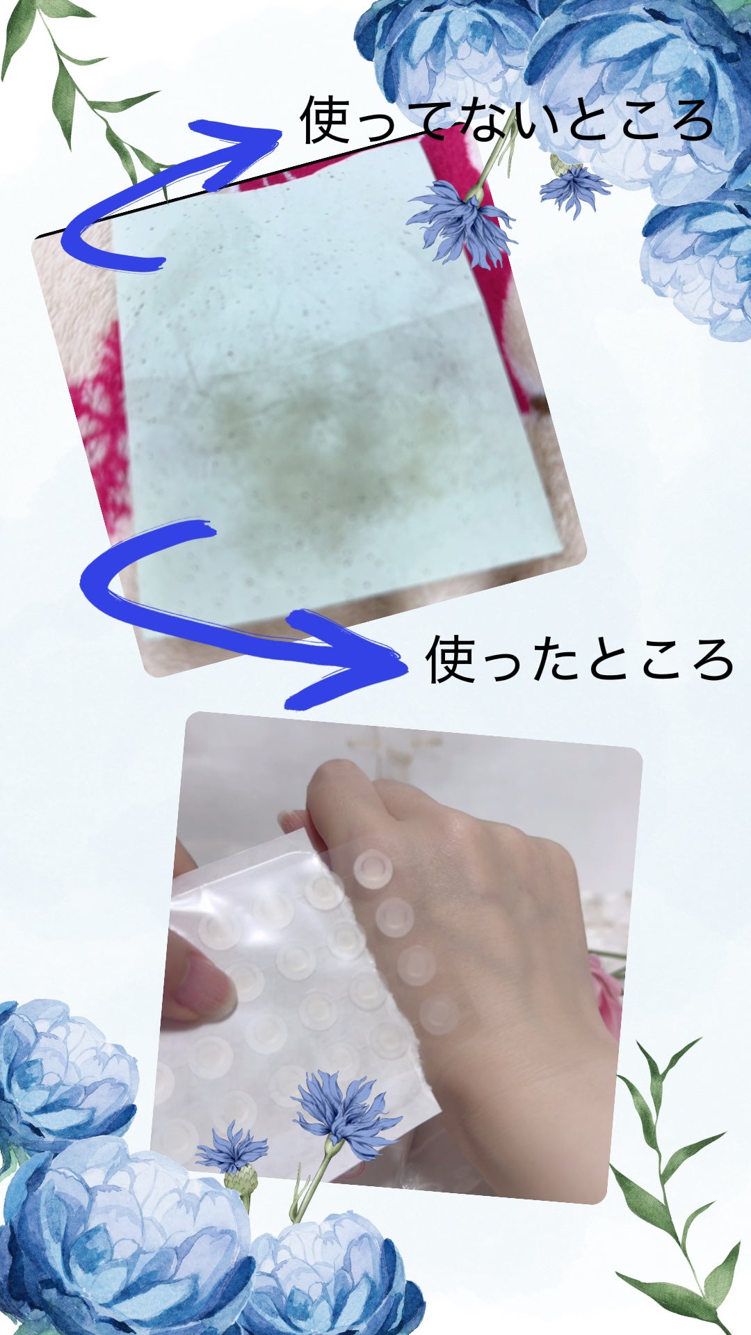 エイクリアスポットキュアパッチ/Dr.G/その他スキンケアを使ったクチコミ(2枚目)