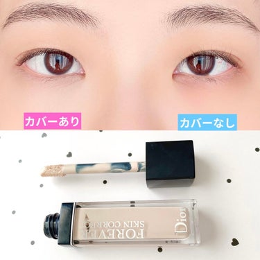 【旧】ディオールスキン フォーエヴァー スキン コレクト コンシーラー/Dior/リキッドコンシーラーを使ったクチコミ（4枚目）