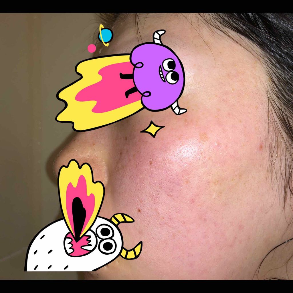 日本酒の化粧水/菊正宗/化粧水を使ったクチコミ（1枚目）