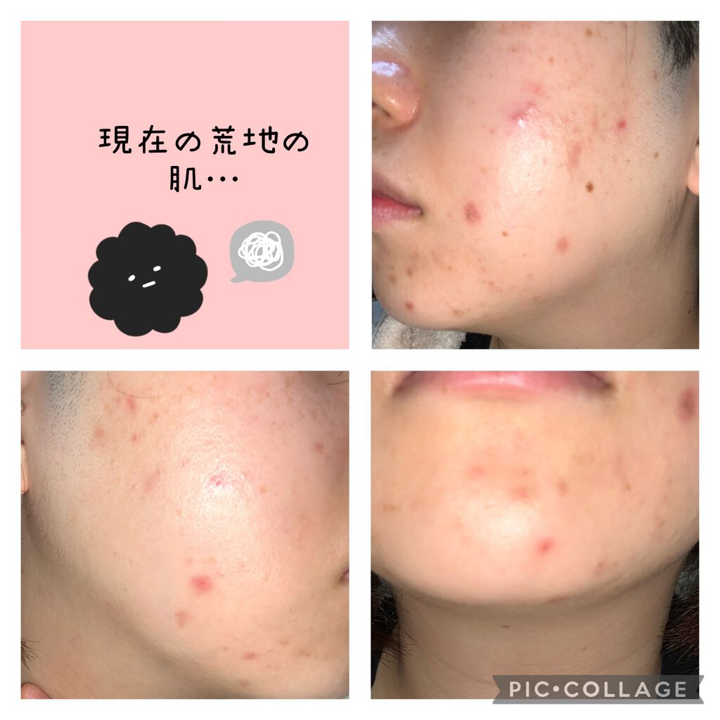 ドクダミ化粧水/ONE THING/化粧水を使ったクチコミ(4枚目)