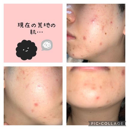 ドクダミ化粧水/ONE THING/化粧水を使ったクチコミ(4枚目)