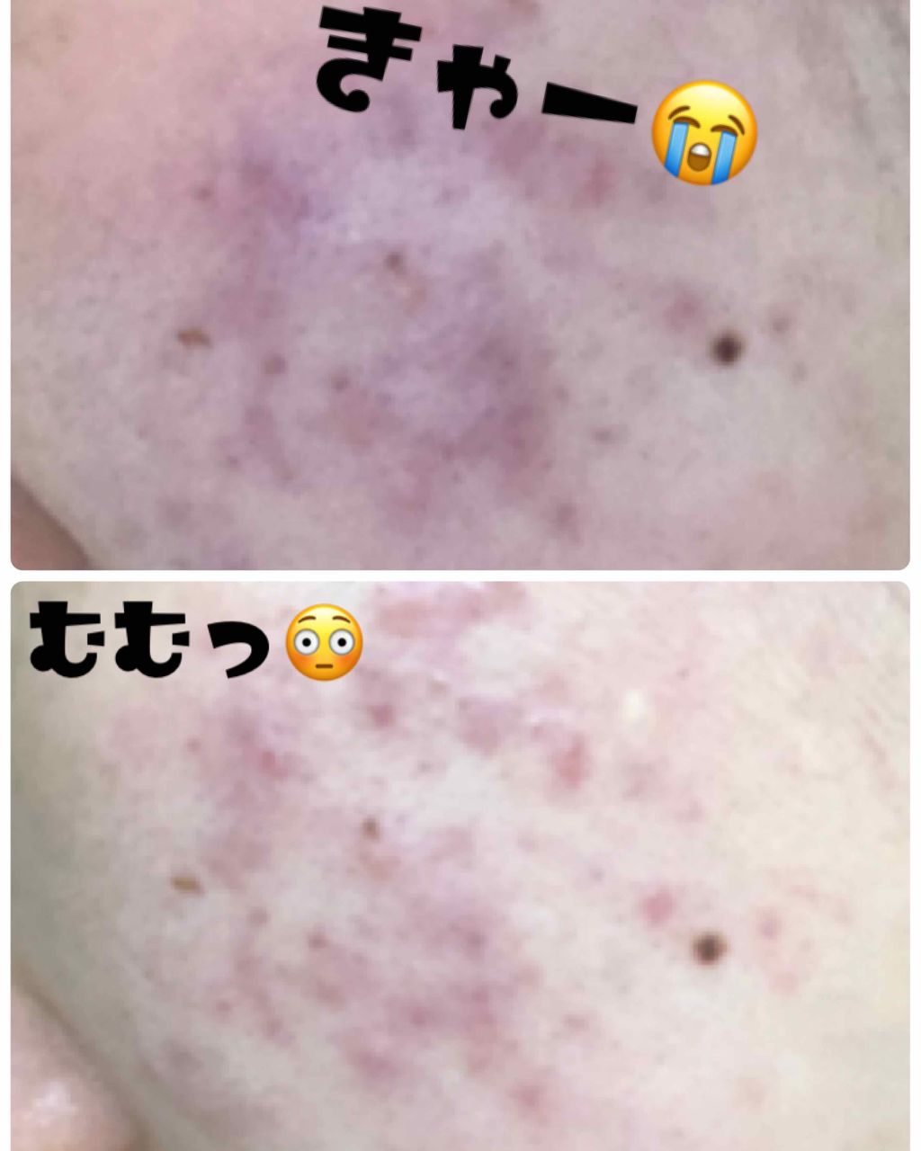 リプライローション/シェルクルール/化粧水を使ったクチコミ(3枚目)