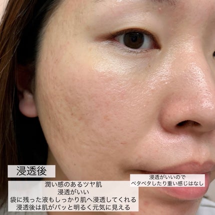 弱酸性pHシートマスク ハニーフィット/Abib /シートマスク・パックを使ったクチコミ(7枚目)