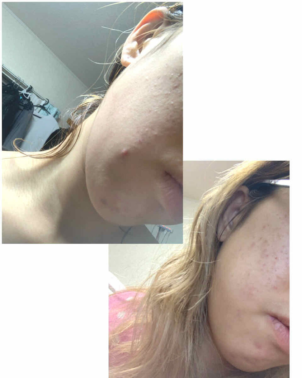 フローラドリップ/ALBION/化粧水を使ったクチコミ（2枚目）