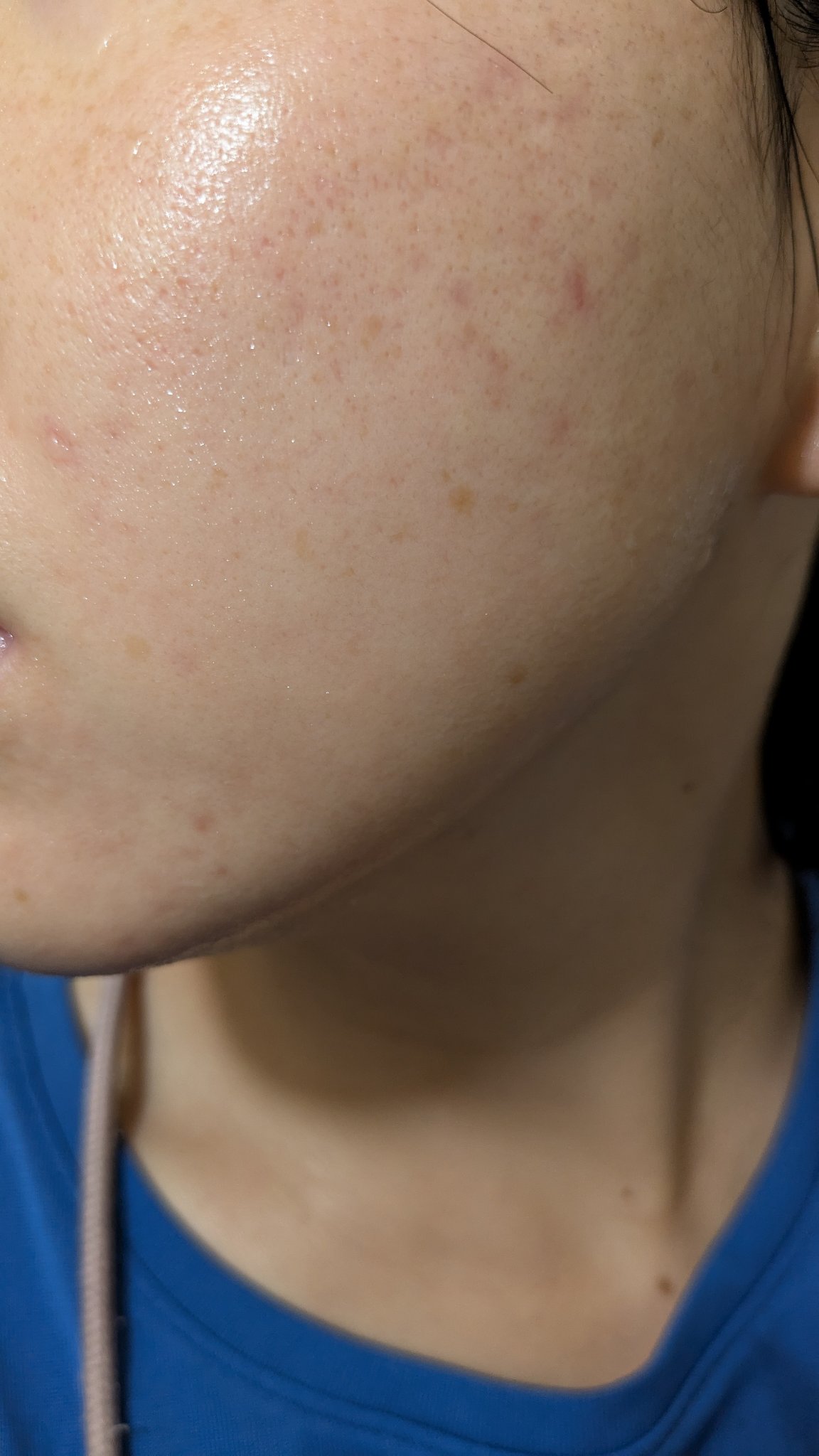 クリーム NC/なめらか本舗/フェイスクリームを使ったクチコミ（2枚目）