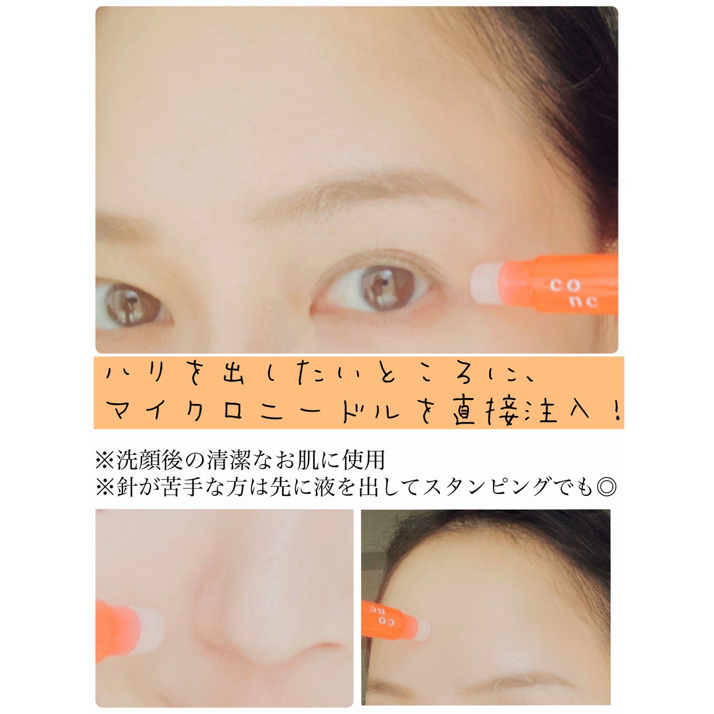 リンクル インジェクション/CONC/美容液を使ったクチコミ(2枚目)