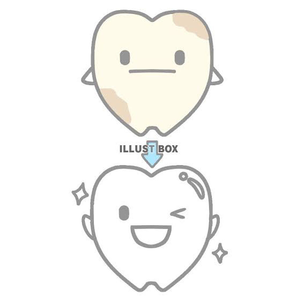 リステリン ホワイトニング/リステリン/マウスウォッシュ・スプレーを使ったクチコミ（1枚目）