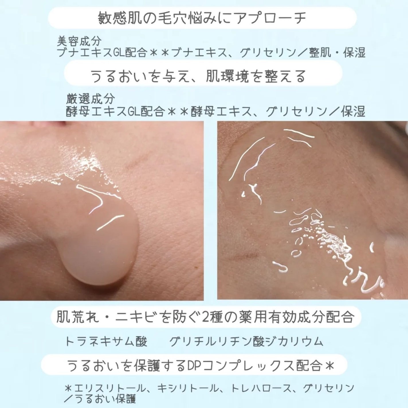 モイストケア ローション MB/d プログラム/化粧水を使ったクチコミ(4枚目)