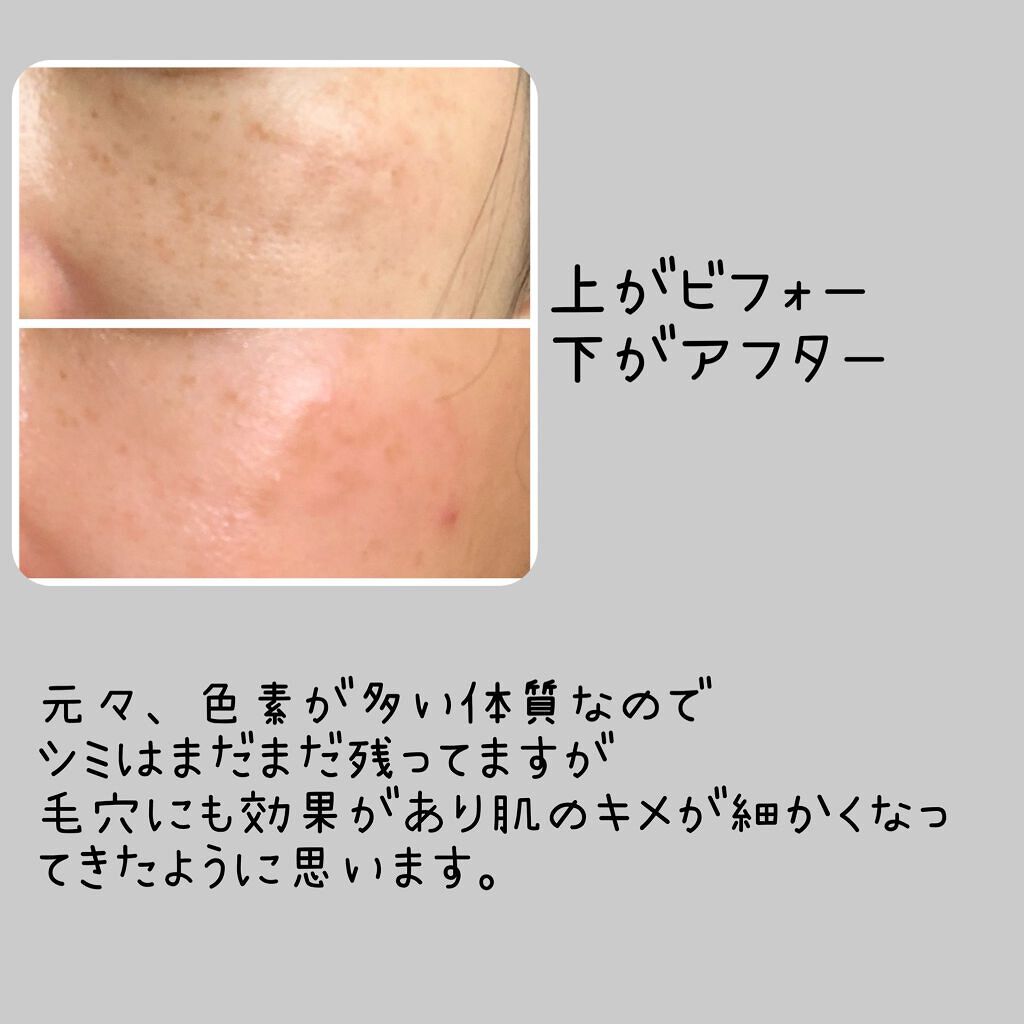 EMAKED(エマーキット)/水橋保寿堂製薬/まつげ美容液を使ったクチコミ(5枚目)