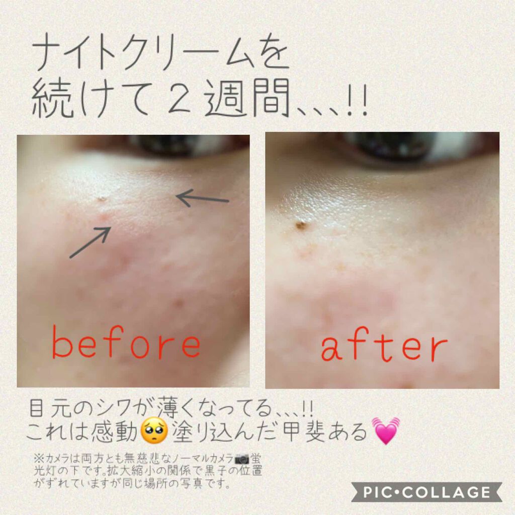 リンクル化粧水 N/なめらか本舗/化粧水を使ったクチコミ(4枚目)