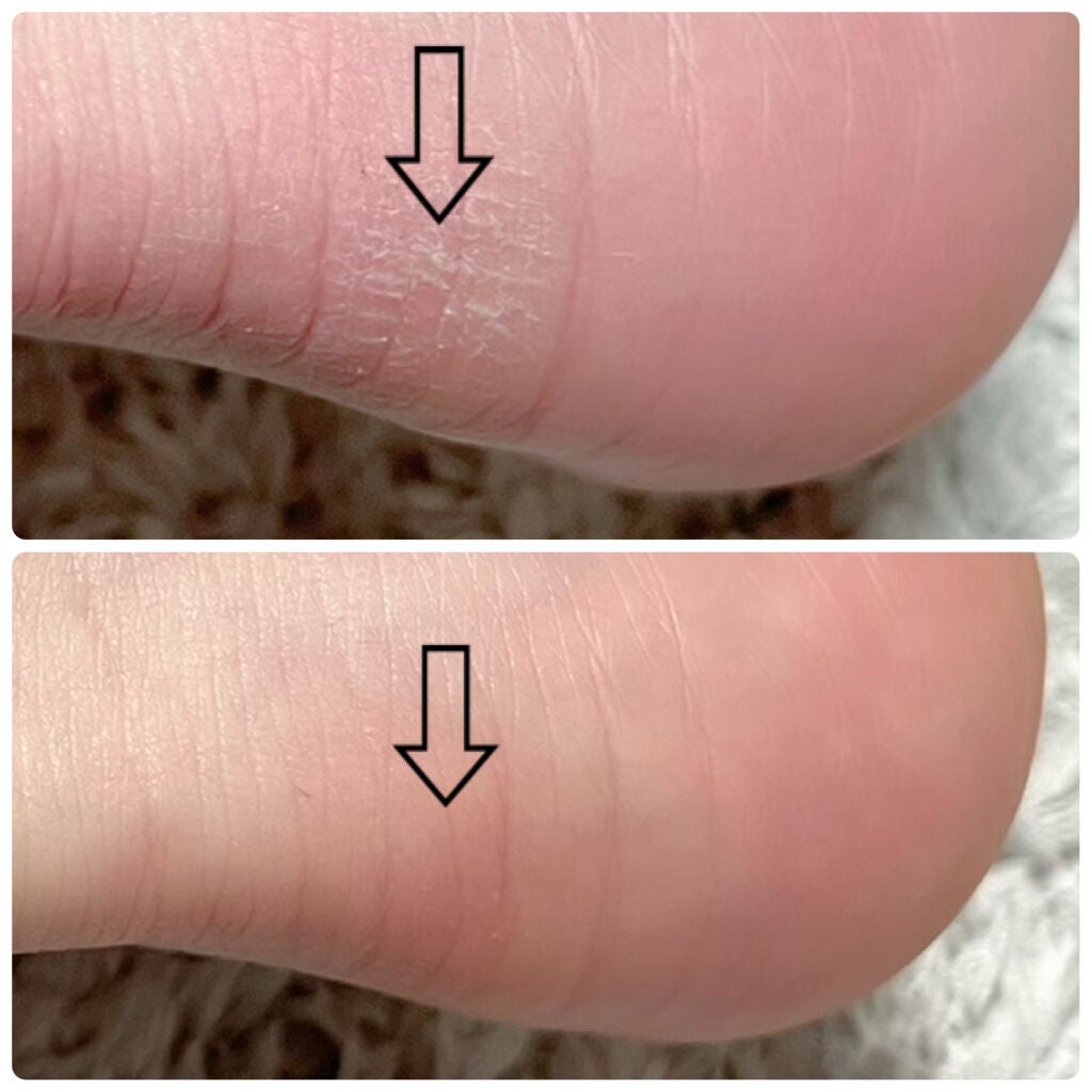 ãã€ãã£ãŒã³ã³ã¯è¬çšãããã±ã¢ããŒã·ã§ã³/ãã€ãã£ãŒã³ã³ã¯/ã¬ãã°ã»ãããã±ã¢ã䜿ã£ãã¯ãã³ãïŒ3æç®ïŒ