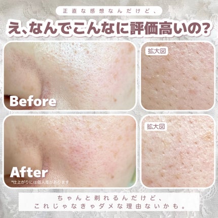 スキムシェーバー/ReFa/シェーバーを使ったクチコミ(7枚目)