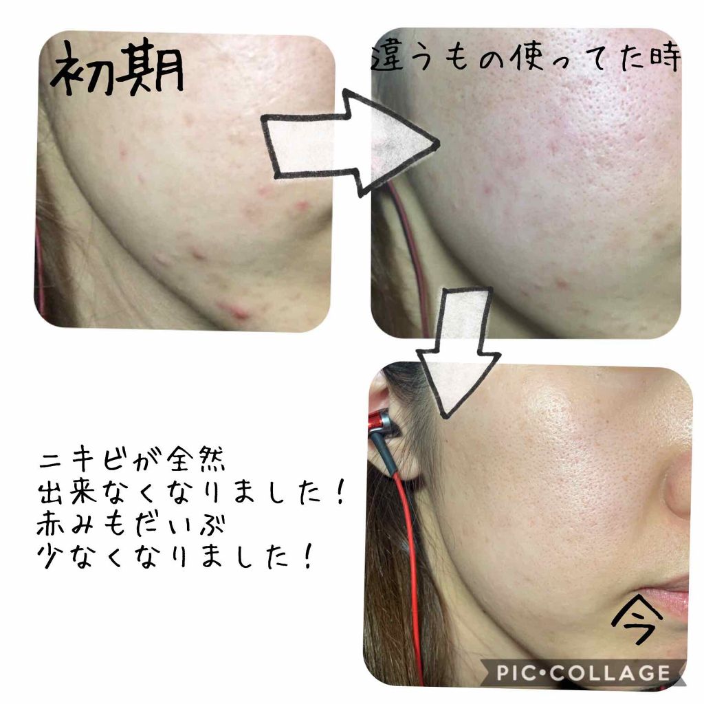 モイスト クレンジング ミルクジェル/アルージェ/クレンジングジェルを使ったクチコミ(3枚目)