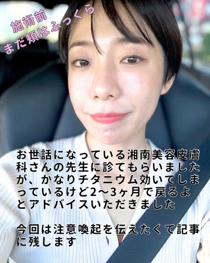 フラッフィーブラーティント/2aN/リップティントを使ったクチコミ(6枚目)