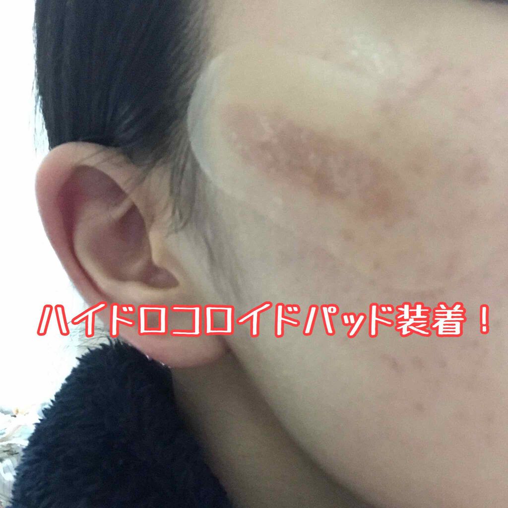 ビタミンC「2000」（医薬品）/武田薬品工業/健康サプリメントを使ったクチコミ（2枚目）