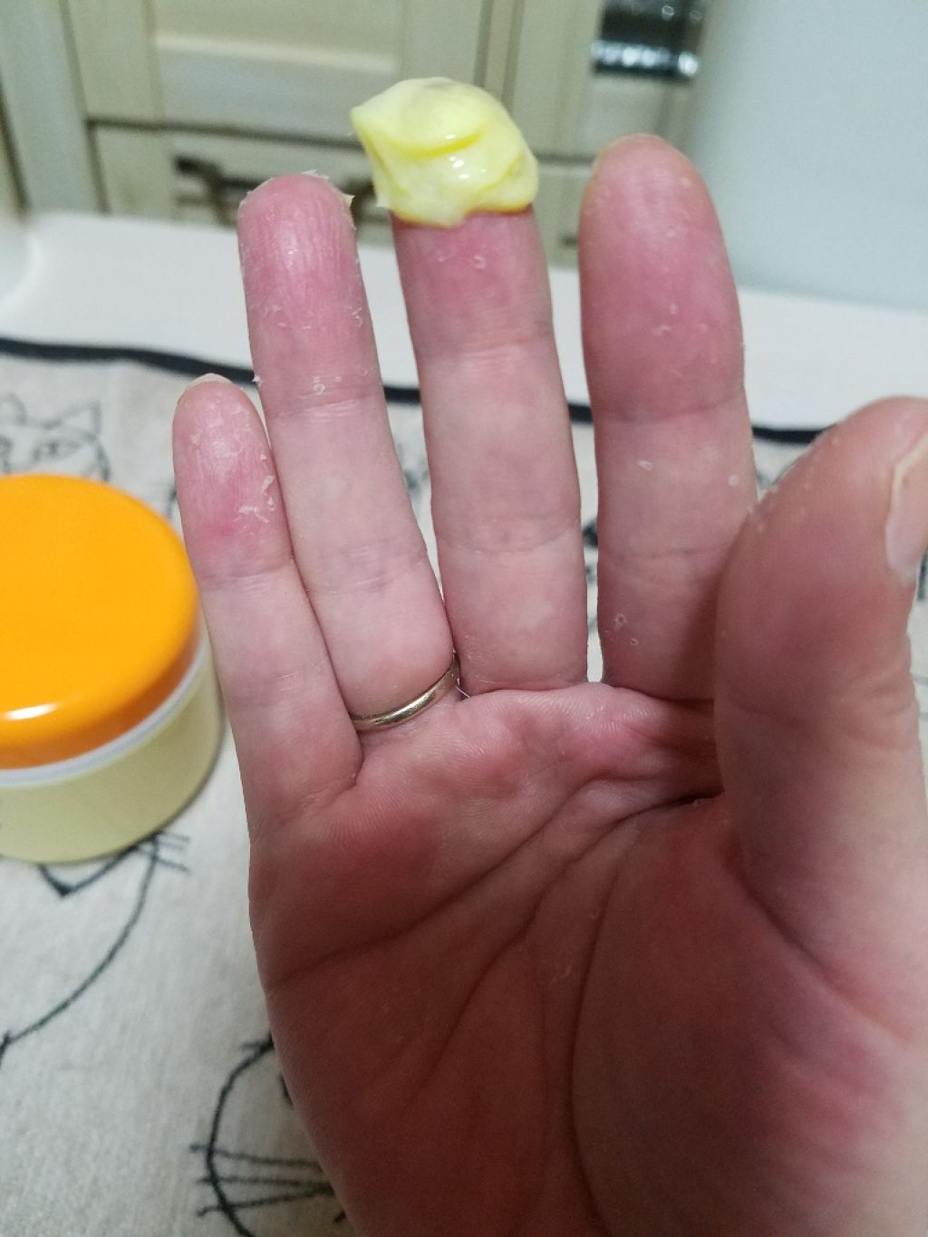 メディカルクリームG(薬用クリームG)/メンターム/ハンドクリームを使ったクチコミ(2枚目)