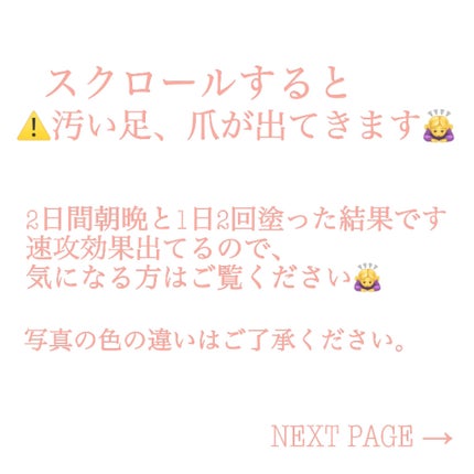 ネイルケアオイル/無印良品/ネイルオイル・トリートメントを使ったクチコミ(4枚目)