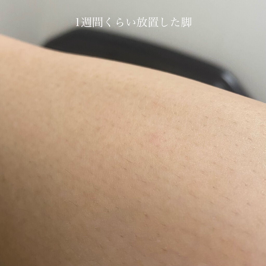 試してみた】FASIZ HAIR REMOVAL 家庭用脱毛器/FASIZ | LIPS