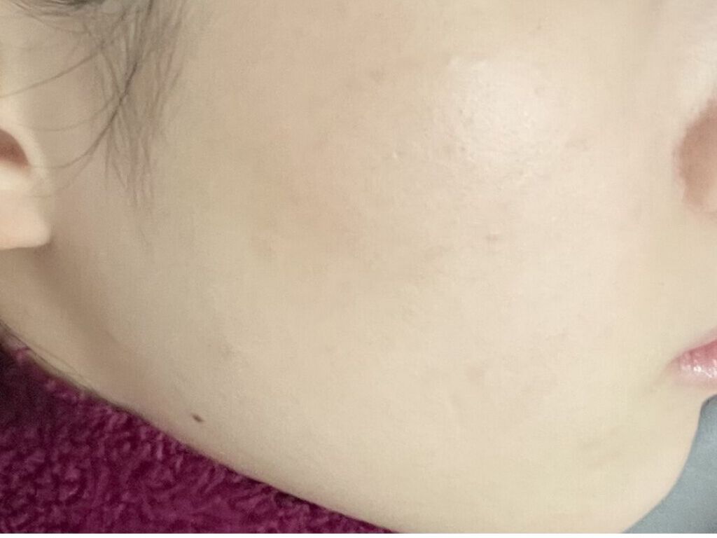 パワーマスク SP/ラッシュ/スクラブ・ゴマージュを使ったクチコミ（2枚目）