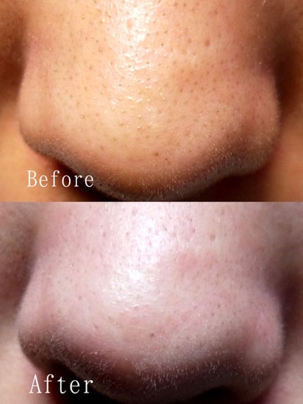 ãããã¡ðæ¯ç©Ž on LIPS ããä»å¹Žãæ¯ç©Žå€§æé€ïŒ(ÂŽ<_ïœ)ðãä¹
ãã¶ãã«æ¯ç©Žã綺éºã«ããŸ..ãïŒ4æç®ïŒ