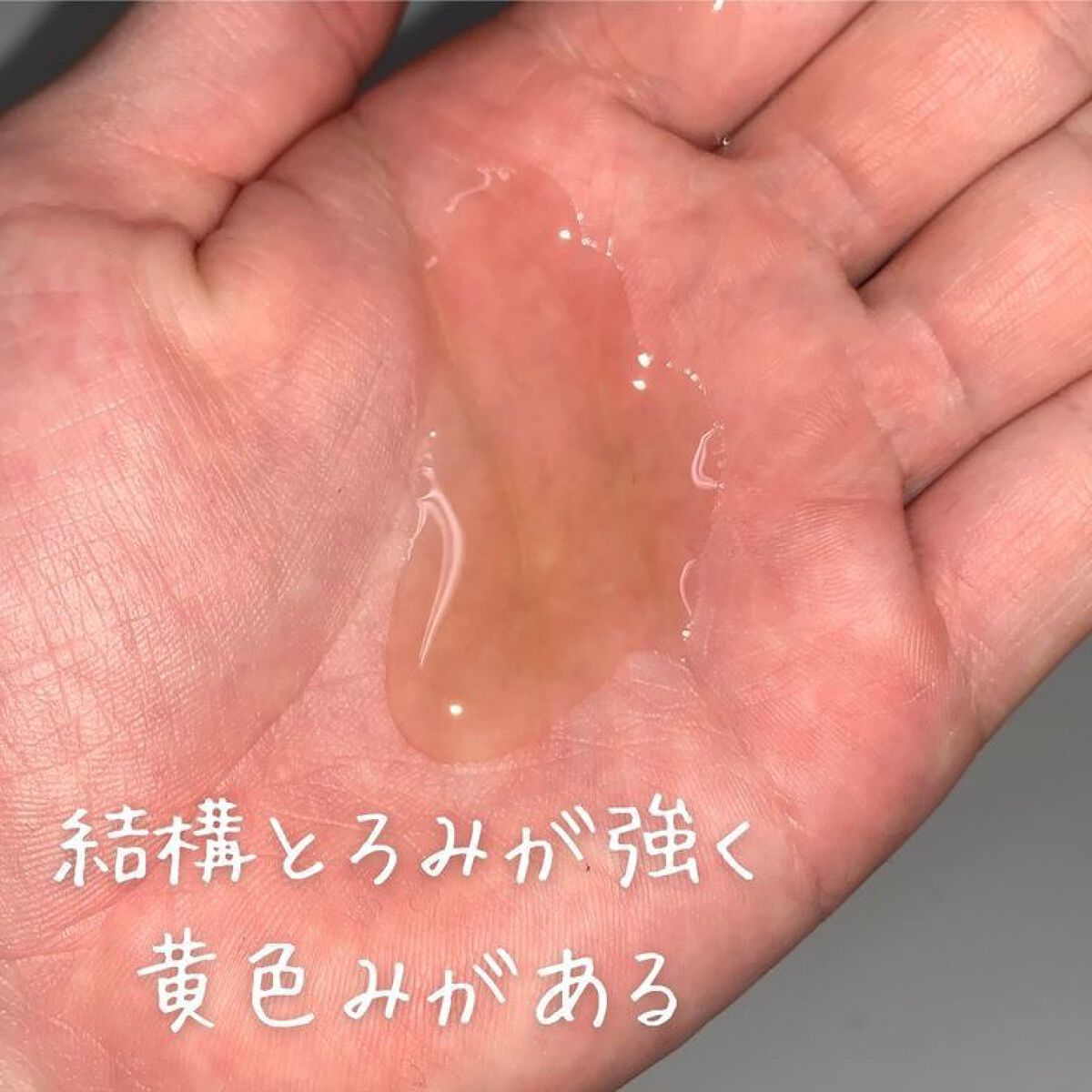 VC100エッセンスローションEXスペシャル/ドクターシーラボⓇ/化粧水を使ったクチコミ（3枚目）