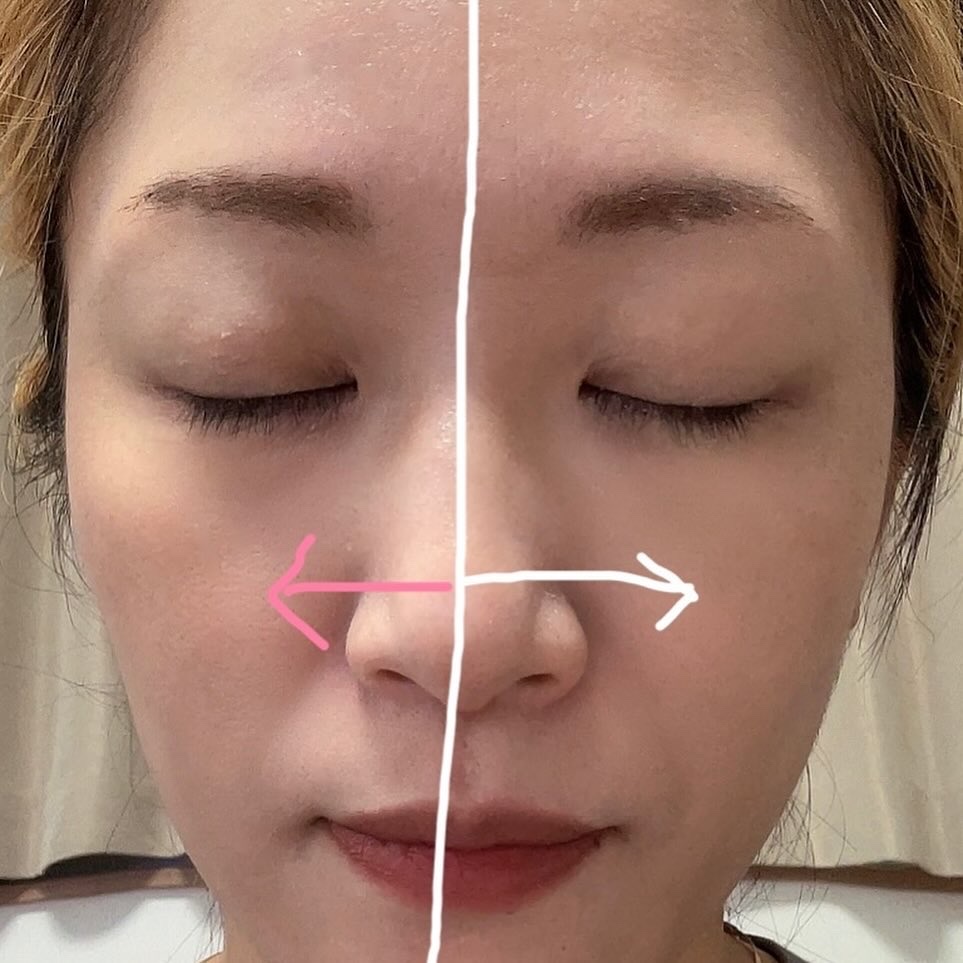 セラムフィット ボリューミング グロースティック/ByUR/ジェル・クリームチークを使ったクチコミ（2枚目）