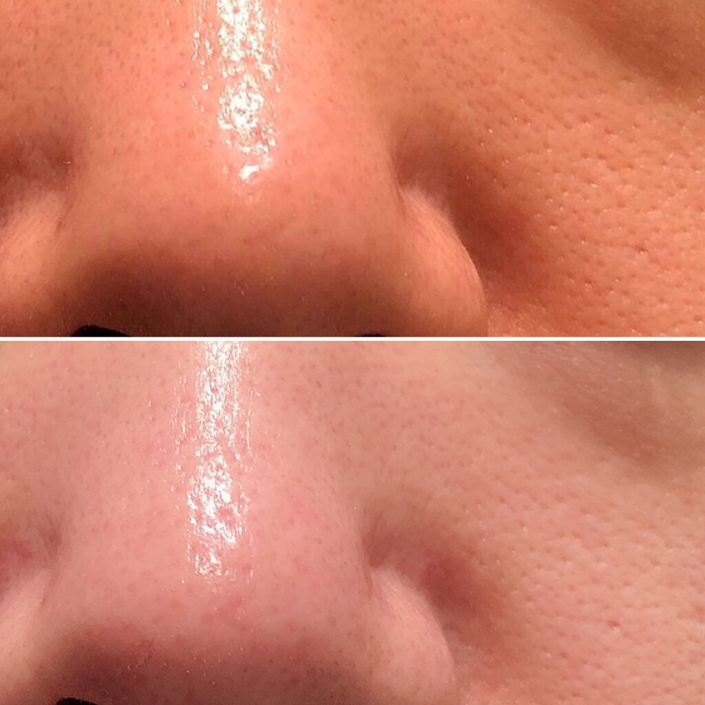 マルチアクアバーム/アクアレーベル/フェイスバームを使ったクチコミ（2枚目）