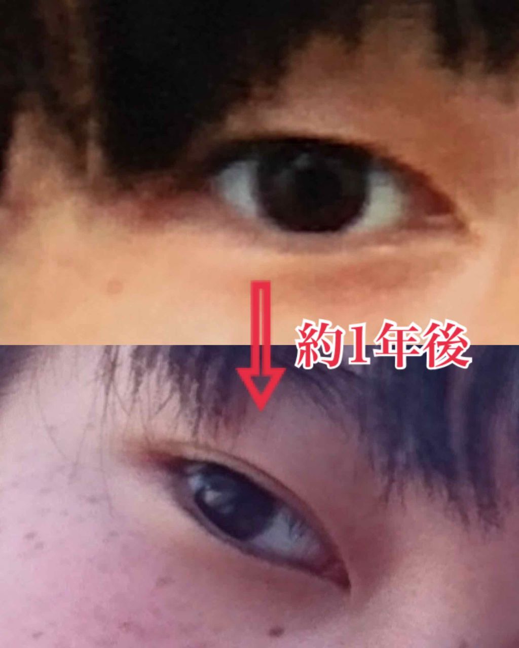 【旧品】オリシキ アイリッドスキンフィルム/D-UP/二重まぶた用アイテムを使ったクチコミ（2枚目）