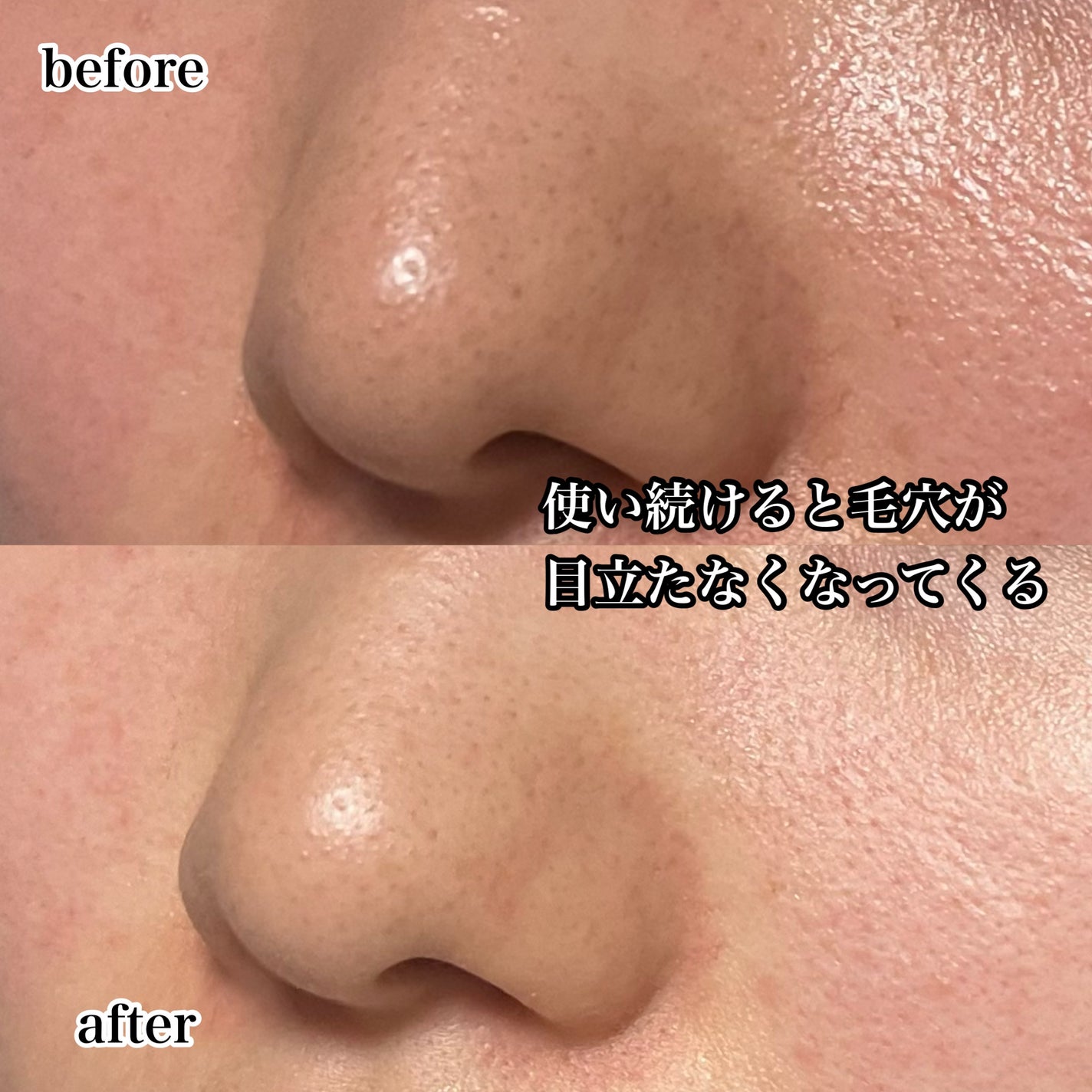 BALM CLEANSE メルティブラック/MELLIFE/クレンジングバームを使ったクチコミ(7枚目)