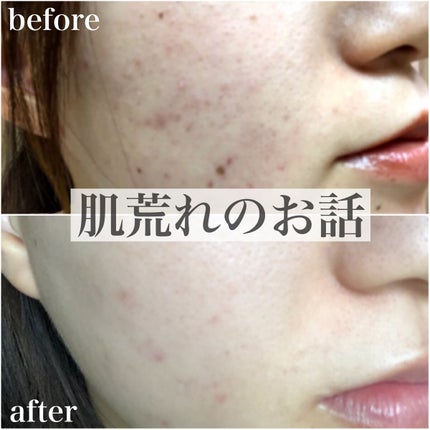 レチノール シカ リペア セラム/innisfree/美容液を使ったクチコミ(1枚目)