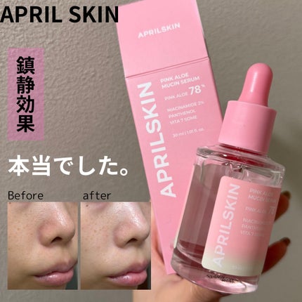 ピンクアロエムチンセラム/APRILSKIN/美容液を使ったクチコミ(1枚目)