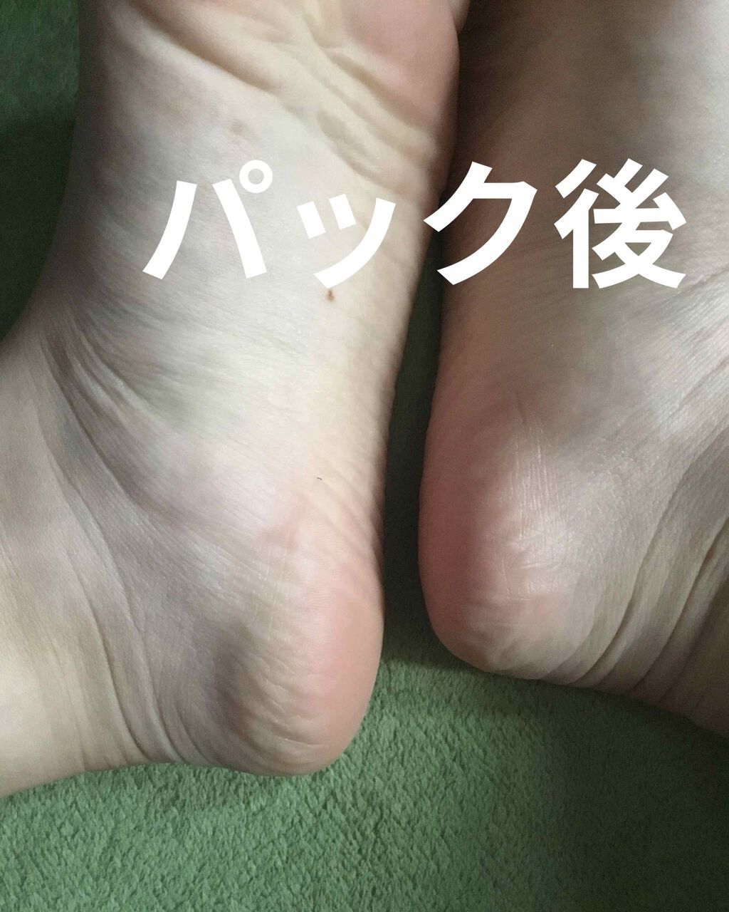 フットマスクパック/DAISO/レッグ・フットケアを使ったクチコミ(4枚目)