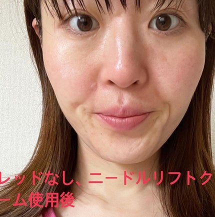 レッドパワー セラム/アイビー/美容液を使ったクチコミ(9枚目)