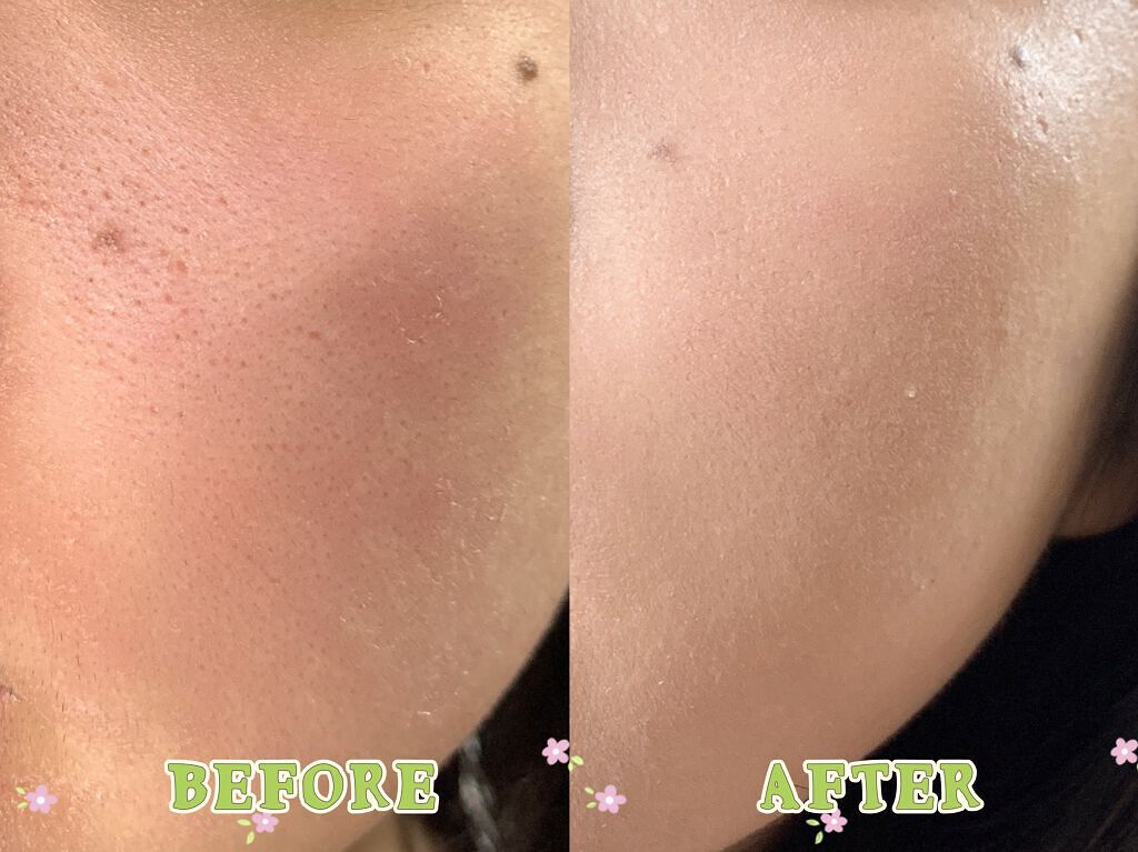 ダブルラスティング クッショングロウ/ETUDE/クッションファンデーションを使ったクチコミ(5枚目)